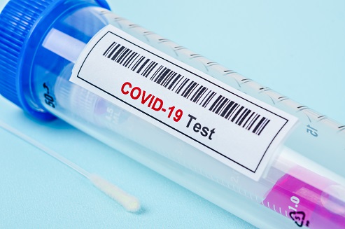 Kötelezhetjük-e koronavírus-tesztre a dolgozókat?